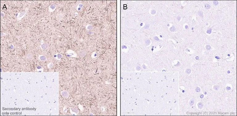 Immunohistochemistry (Formalin/PFA-fixed paraffin-embedded sections) - Anti-Tau (phospho S396) antibody [E178] - BSA and Azide free (AB218600)