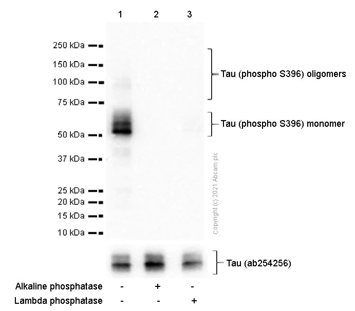 Western blot - Anti-Tau (phospho S396) antibody [E178] - BSA and Azide free (AB218600)