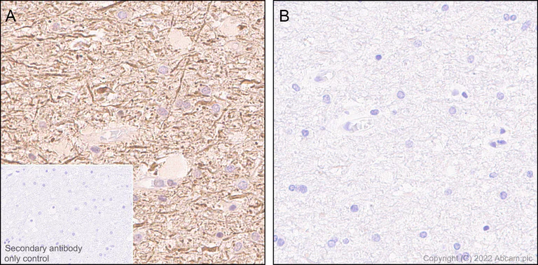 Immunohistochemistry (Formalin/PFA-fixed paraffin-embedded sections) - Anti-Tau (phospho S396) antibody [E178] - Mouse IgG2a (Chimeric) - BSA and Azide free (AB302491)