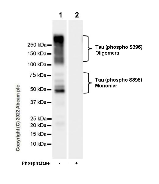 Western blot - Anti-Tau (phospho S396) antibody [E178] - Mouse IgG2a (Chimeric) - BSA and Azide free (AB302491), expandable thumbnail