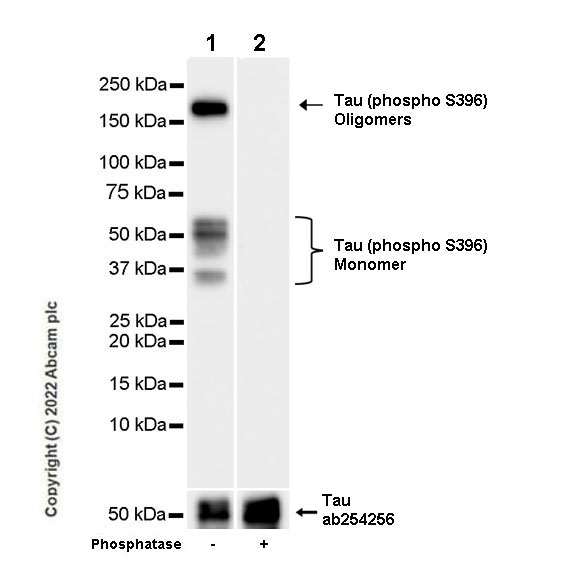 Western blot - Anti-Tau (phospho S396) antibody [E178] - Mouse IgG2a (Chimeric) - BSA and Azide free (AB302491), expandable thumbnail