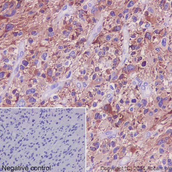 Immunohistochemistry (Formalin/PFA-fixed paraffin-embedded sections) - Anti-Tau (phospho S396) antibody [EPR2731] (AB109390)