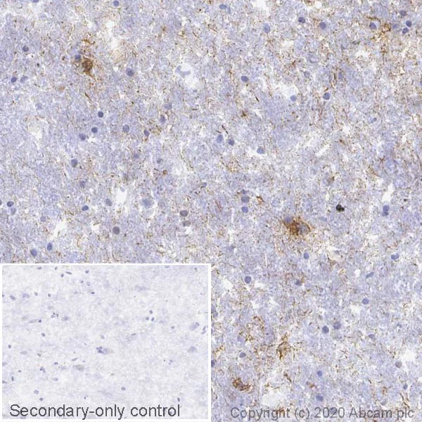 Immunohistochemistry (Frozen sections) - Anti-Tau (phospho S396) antibody [EPR2731] (AB109390)
