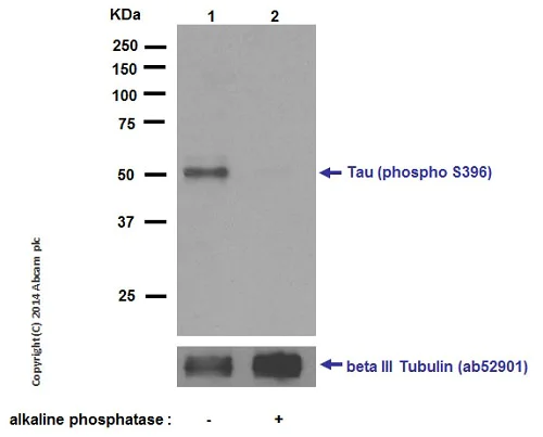 Western blot - Anti-Tau (phospho S396) antibody [EPR2731] (AB109390)