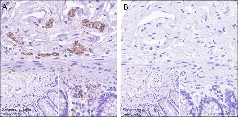 Immunohistochemistry (Formalin/PFA-fixed paraffin-embedded sections) - Anti-Tau (phospho S396) antibody [EPR2731] - BSA and Azide free (AB156623)
