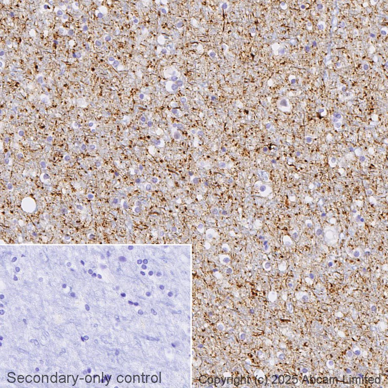 Immunohistochemistry (Formalin/PFA-fixed paraffin-embedded sections) - Anti-Tau (phospho S396) antibody [EPR2731] - BSA and Azide free (AB156623)