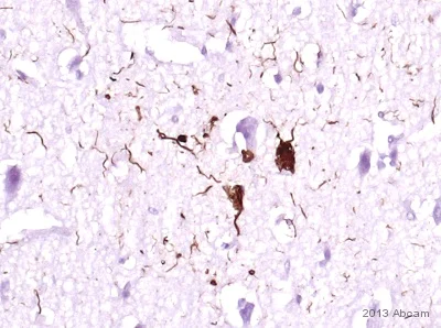 Immunohistochemistry (Formalin/PFA-fixed paraffin-embedded sections) - Anti-Tau (phospho S396) antibody [EPR2731] - BSA and Azide free (AB156623)