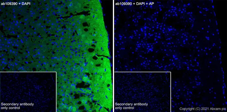 Immunohistochemistry (Frozen sections) - Anti-Tau (phospho S396) antibody [EPR2731] - BSA and Azide free (AB156623)