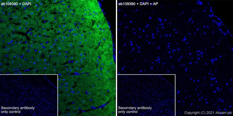 Immunohistochemistry (Frozen sections) - Anti-Tau (phospho S396) antibody [EPR2731] - BSA and Azide free (AB156623)