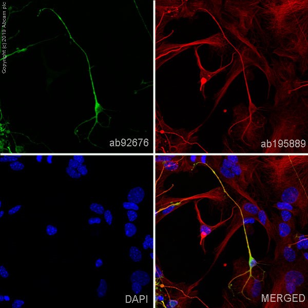 Immunocytochemistry/ Immunofluorescence - Anti-Tau (phospho S404) antibody [EPR2605] (ab92676), expandable thumbnail