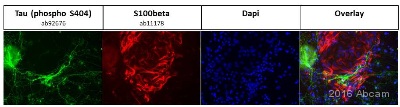 Immunocytochemistry/ Immunofluorescence - Anti-Tau (phospho S404) antibody [EPR2605] (ab92676), expandable thumbnail