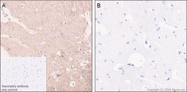 Immunohistochemistry (Formalin/PFA-fixed paraffin-embedded sections) - Anti-Tau (phospho S404) antibody [EPR2605] (AB92676), expandable thumbnail