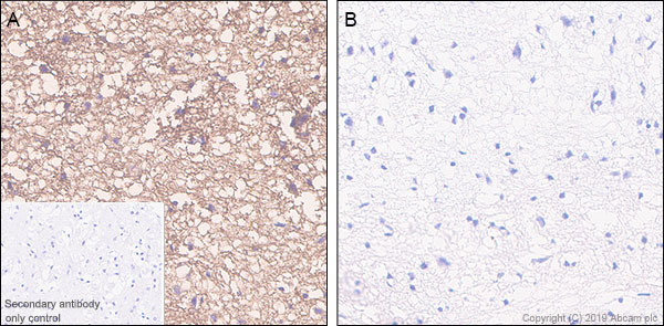 Immunohistochemistry (Formalin/PFA-fixed paraffin-embedded sections) - Anti-Tau (phospho S404) antibody [EPR2605] (AB92676), expandable thumbnail