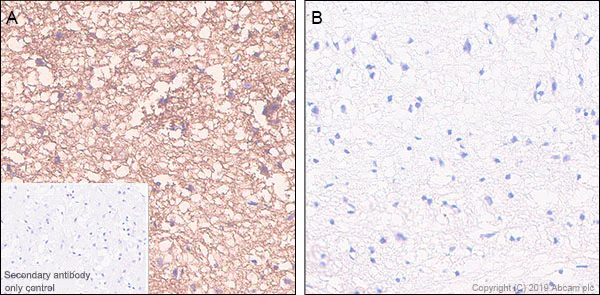 Immunohistochemistry (Formalin/PFA-fixed paraffin-embedded sections) - Anti-Tau (phospho S404) antibody [EPR2605] (AB92676)