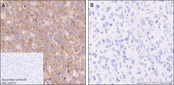 Immunohistochemistry (Formalin/PFA-fixed paraffin-embedded sections) - Anti-Tau (phospho S404) antibody [EPR2605] (AB92676), expandable thumbnail