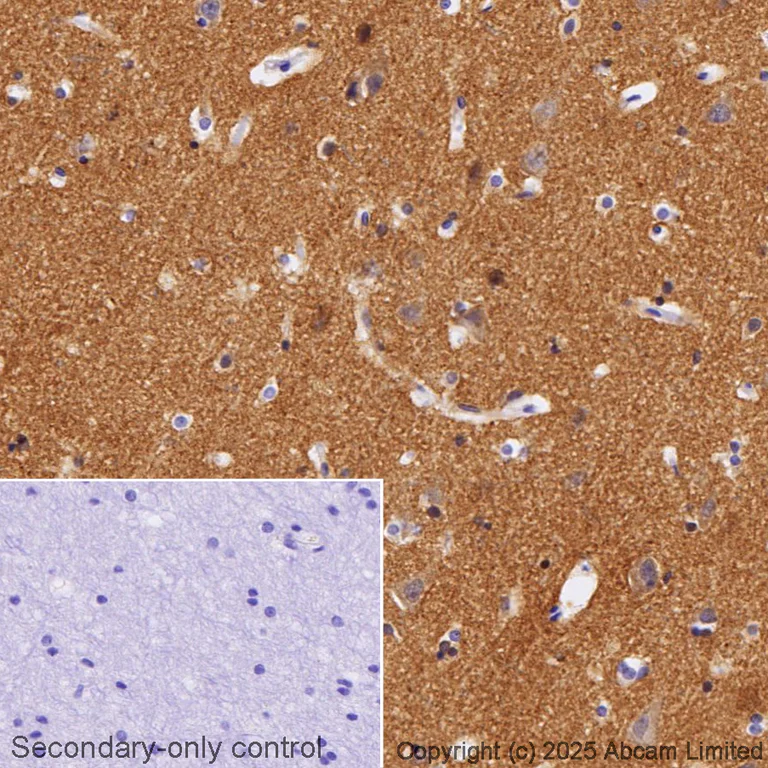 Immunohistochemistry (Formalin/PFA-fixed paraffin-embedded sections) - Anti-Tau (phospho S404) antibody [EPR2605] (AB92676)