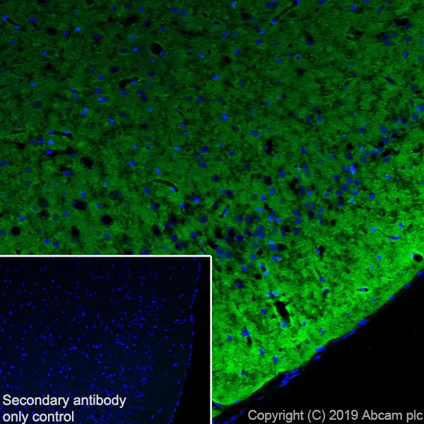 Immunohistochemistry (Frozen sections) - Anti-Tau (phospho S404) antibody [EPR2605] (AB92676)