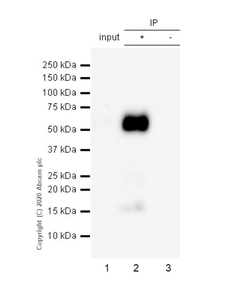 Immunoprecipitation - Anti-Tau (phospho S404) antibody [EPR2605] (AB92676), expandable thumbnail