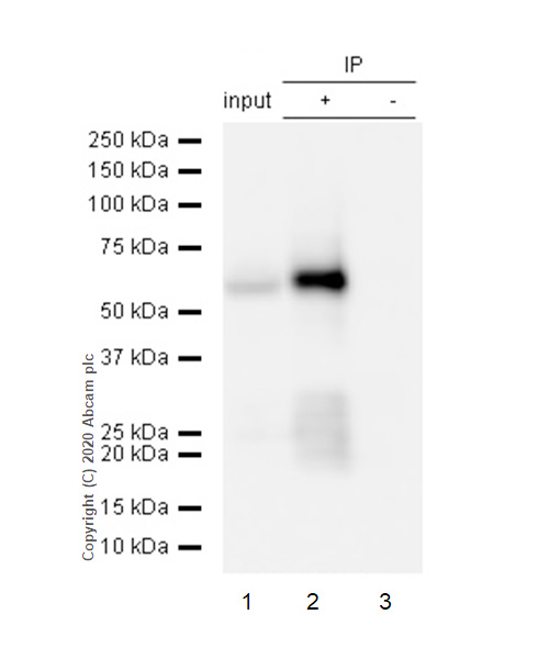 Immunoprecipitation - Anti-Tau (phospho S404) antibody [EPR2605] (AB92676), expandable thumbnail