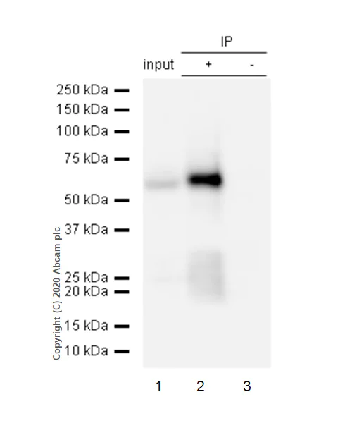 Immunoprecipitation - Anti-Tau (phospho S404) antibody [EPR2605] (AB92676)