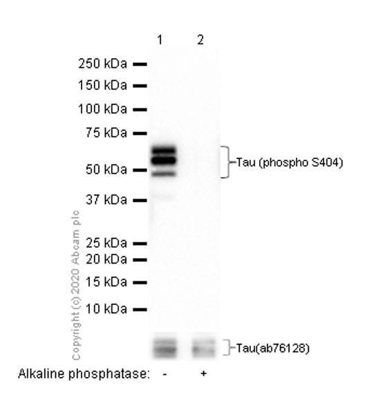 Western blot - Anti-Tau (phospho S404) antibody [EPR2605] (ab92676), expandable thumbnail