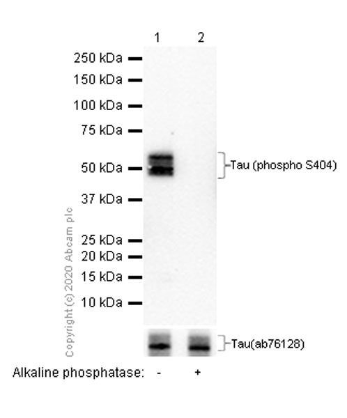 Western blot - Anti-Tau (phospho S404) antibody [EPR2605] (ab92676), expandable thumbnail