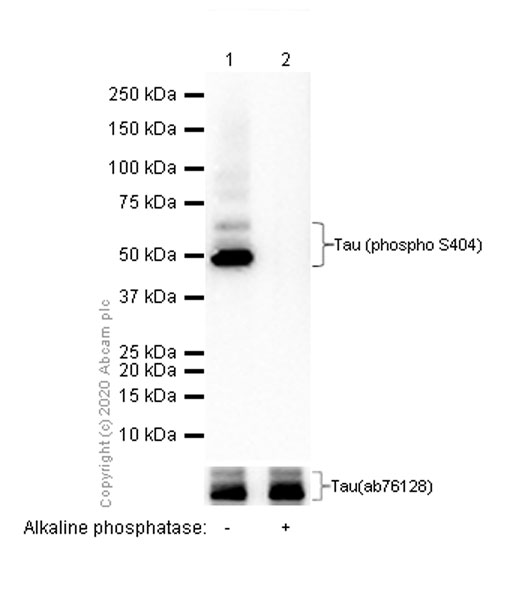 Western blot - Anti-Tau (phospho S404) antibody [EPR2605] (ab92676), expandable thumbnail