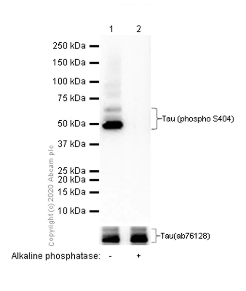 Western blot - Anti-Tau (phospho S404) antibody [EPR2605] (AB92676)