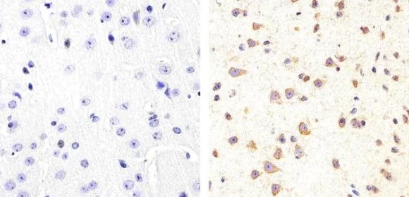 Immunohistochemistry (Formalin/PFA-fixed paraffin-embedded sections) - Anti-Tau (phospho S409) antibody (AB4861)