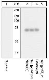 Western blot - Anti-Tau (phospho S409) antibody (AB4861)