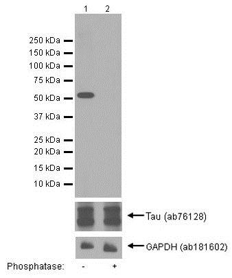 Western blot - Anti-Tau (phospho S422) antibody [EPR2866] (AB79415)