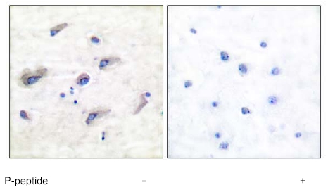Immunohistochemistry (Formalin/PFA-fixed paraffin-embedded sections) - Anti-Tau (phospho Ser673) antibody (AB51036)