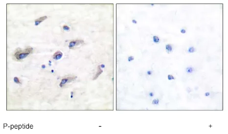Immunohistochemistry (Formalin/PFA-fixed paraffin-embedded sections) - Anti-Tau (phospho Ser673) antibody (AB51036)