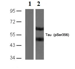 Western blot - Anti-Tau (Phospho Ser673) Antibody (AB75603)