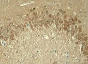 Anti-Tau (phospho T181) antibody. Rabbit polyclonal (ab75679) | Abcam