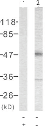 Western blot - Anti-Tau (phospho T181) antibody (AB75679), expandable thumbnail