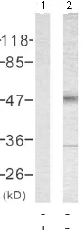 Western blot - Anti-Tau (phospho T181) antibody (AB75679)