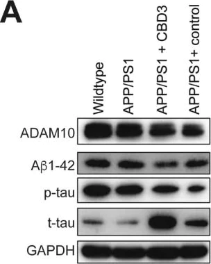 Western blot - Anti-Tau (phospho T181) antibody (AB75679)