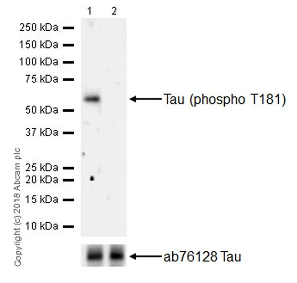 Western blot - Anti-Tau (phospho T181) antibody [EPR22064] - BSA and Azide free (AB240579)