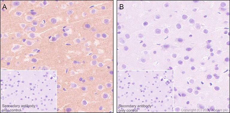 Immunohistochemistry (Formalin/PFA-fixed paraffin-embedded sections) - Anti-Tau (phospho T181) antibody [EPR23506-107] - BSA and Azide free (AB277644)