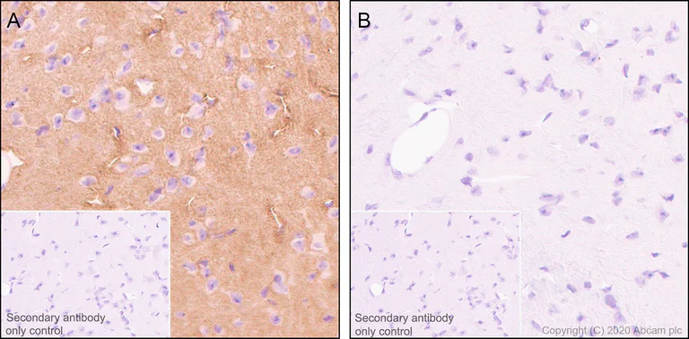 Immunohistochemistry (Formalin/PFA-fixed paraffin-embedded sections) - Anti-Tau (phospho T181) antibody [EPR23506-107] - BSA and Azide free (AB277644)
