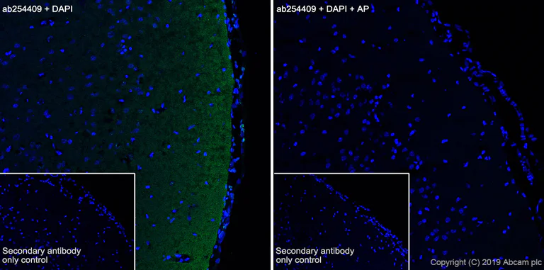 Immunohistochemistry (Frozen sections) - Anti-Tau (phospho T181) antibody [EPR23506-107] - BSA and Azide free (AB277644)