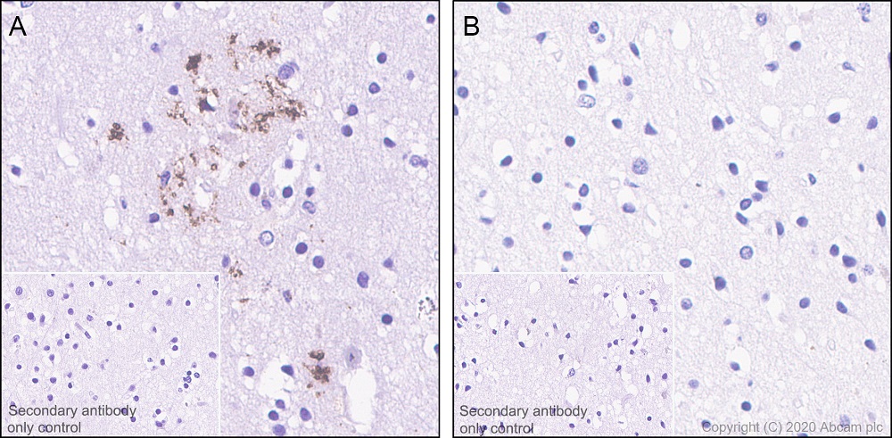 Immunohistochemistry (Formalin/PFA-fixed paraffin-embedded sections) - Anti-Tau (phospho T205) antibody [EPR23505-13] - BSA and Azide free (ab275027), expandable thumbnail
