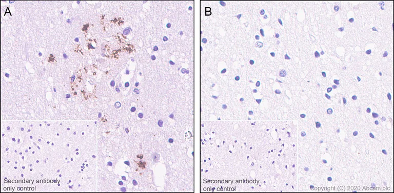 Immunohistochemistry (Formalin/PFA-fixed paraffin-embedded sections) - Anti-Tau (phospho T205) antibody [EPR23505-13] - BSA and Azide free (AB275027)