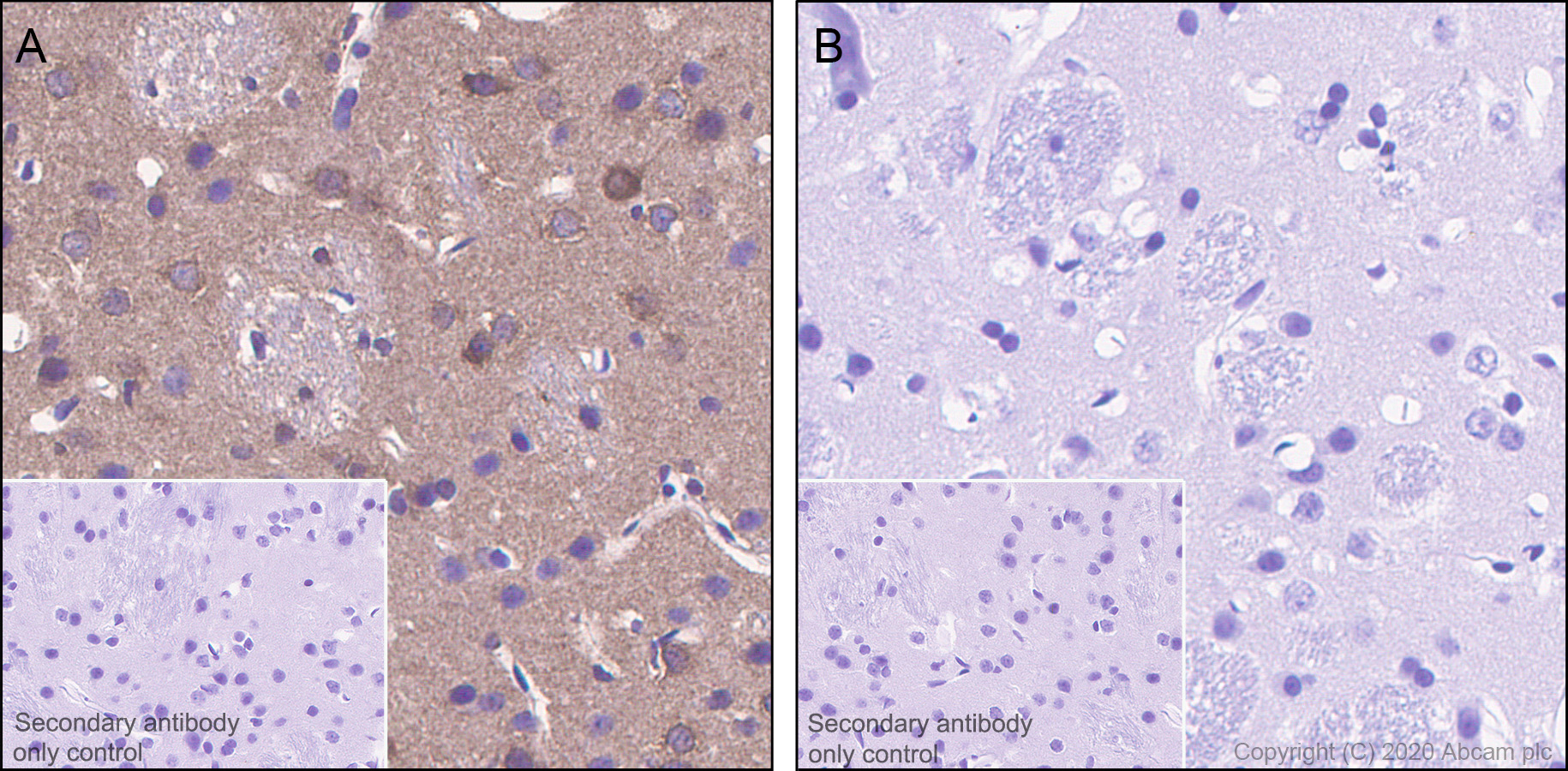 Immunohistochemistry (Formalin/PFA-fixed paraffin-embedded sections) - Anti-Tau (phospho T205) antibody [EPR23505-13] - BSA and Azide free (AB275027), expandable thumbnail