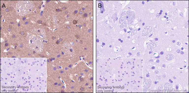 Immunohistochemistry (Formalin/PFA-fixed paraffin-embedded sections) - Anti-Tau (phospho T205) antibody [EPR23505-13] - BSA and Azide free (AB275027)