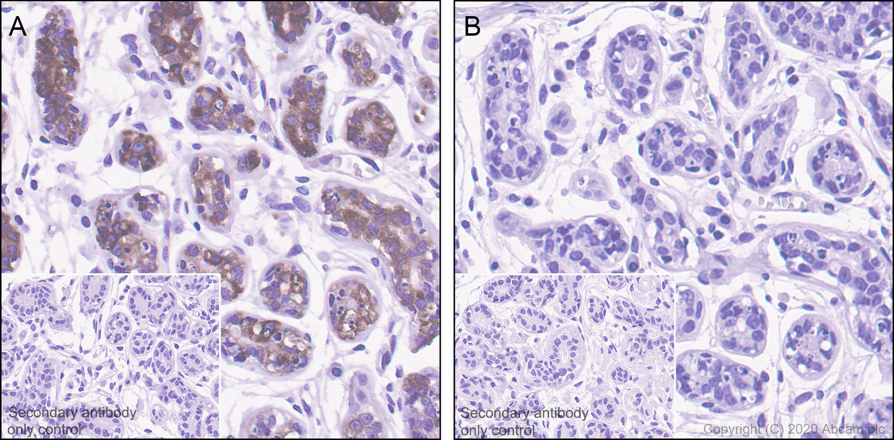 Immunohistochemistry (Formalin/PFA-fixed paraffin-embedded sections) - Anti-Tau (phospho T205) antibody [EPR23505-13] - BSA and Azide free (ab275027), expandable thumbnail
