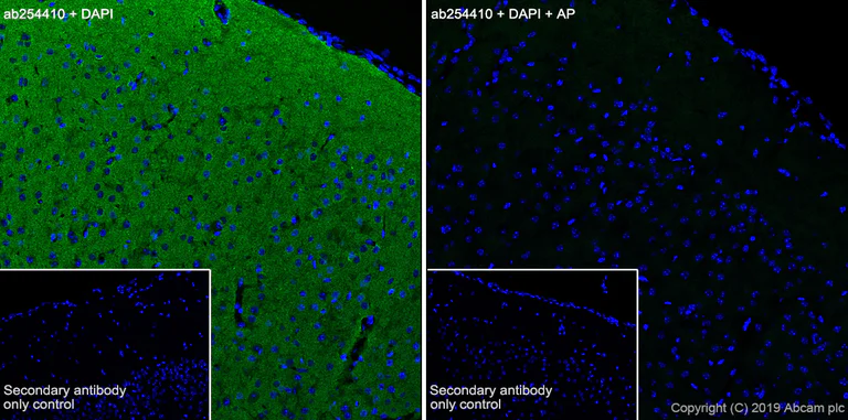 Immunohistochemistry (Frozen sections) - Anti-Tau (phospho T205) antibody [EPR23505-13] - BSA and Azide free (AB275027)