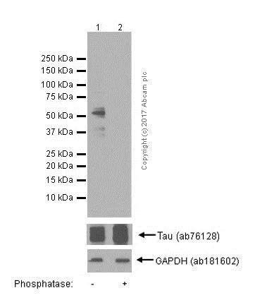 Western blot - Anti-Tau (phospho T205) antibody [EPR2403(2)] - BSA and Azide free (AB244238)