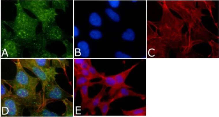 Immunocytochemistry/ Immunofluorescence - Anti-Tau (phospho T212) antibody (AB4842)